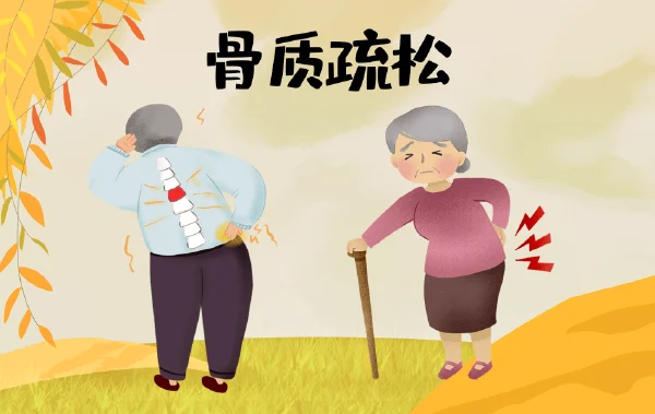 防治骨质疏松症:别让它偷走你的骨骼健康!