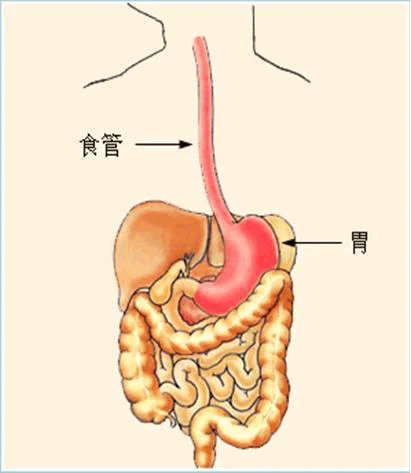 急性上消化道出血——如何预防和应对?